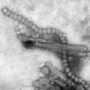 Electron_micrograph_of_Influenza_A_H7N9